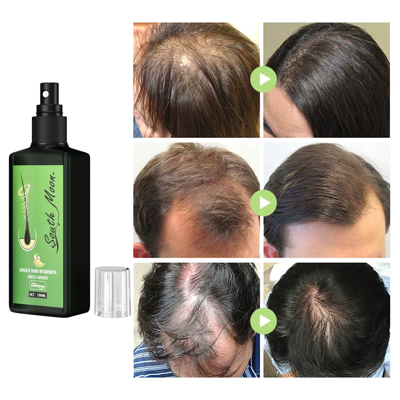 HairVitaX – Soin Puissant Pousse Cheveux