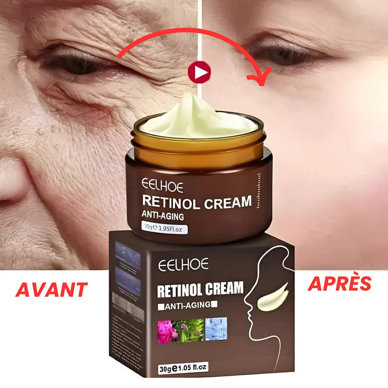 Crème ANTI-AGE 30ML ( Paraissez 10 à 20 ans plus Jeune ! )
