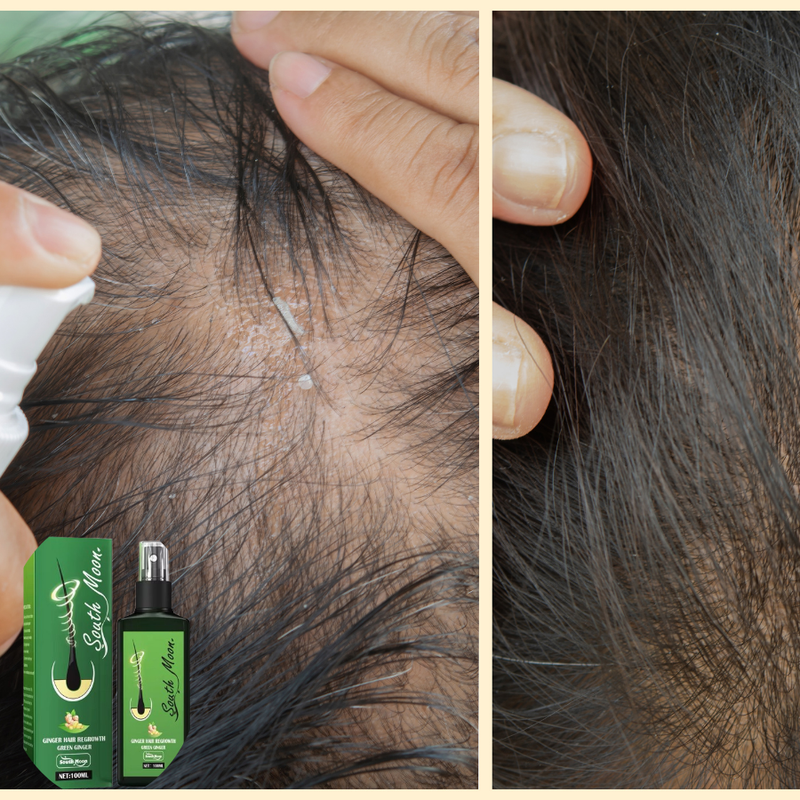 HairVitaX – Soin Puissant Pousse Cheveux