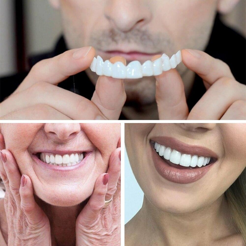Snap on Smile : Confort et ajustement parfait