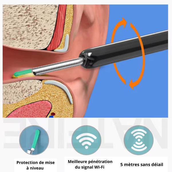 Lumora HD-  Nettoyeur d'oreille intelligent avec caméra HD